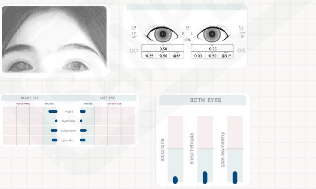 Illustrative vision detail from a SKIDS screening report